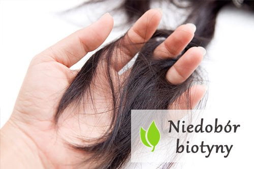 Biotyna