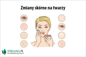 Zmiany skórne na twarzy