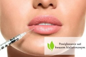 Powiększanie ust kwasem hialuronowy