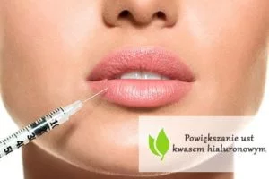 Powiększanie ust kwasem hialuronowy