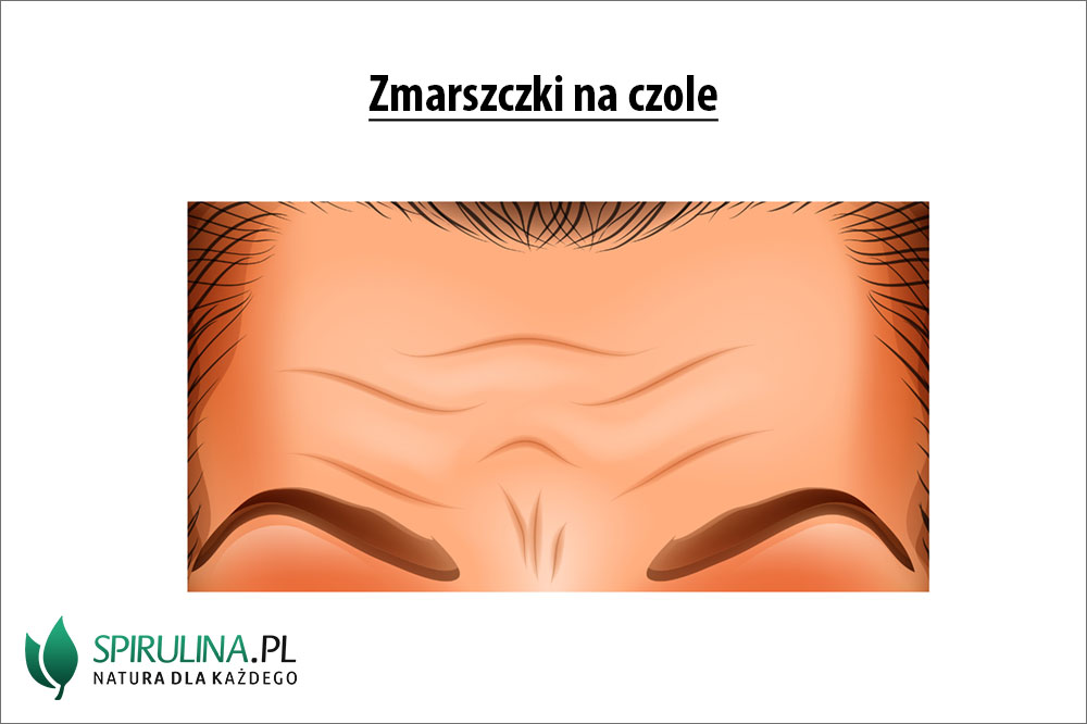 zmarszczki na czole