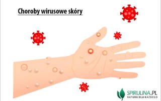 Choroby wirusowe skóry