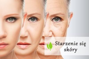 Starzenie się skóry - przyczyny i objawy
