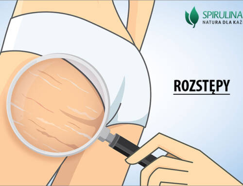 Rozstępy