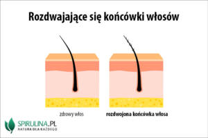 Rozdwajające się końcówki włosów