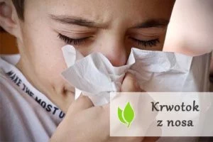 Krwotok z nosa - przyczyny i pierwsza pomoc