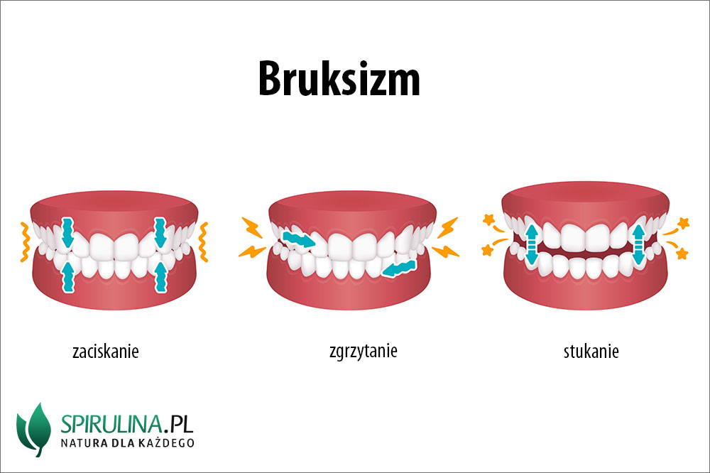 Bruksizm (zgrzytanie zębami) Bruksizm (zgrzytanie zębami)
