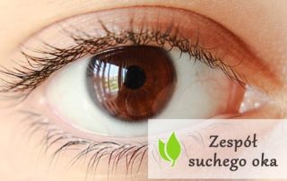Zespół suchego oka - objawy i leczenie