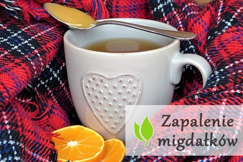 Zapalenie migdałków – przyczyny, objawy, leczenie Zapalenie migdałków - przyczyny, objawy, leczenie
