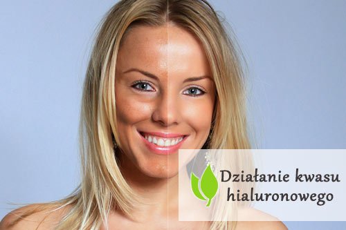 Działanie kwasu hialuronowego Działanie kwasu hialuronowego