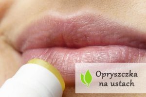 Opryszczka na ustach - przyczyny i leczenie