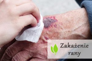 Zakażenie rany - objawy i leczenie