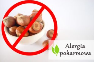 Alergia pokarmowa