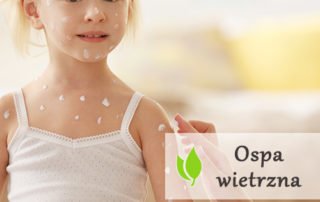 Ospa wietrzna