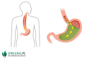 Co jeść przy refluksie?