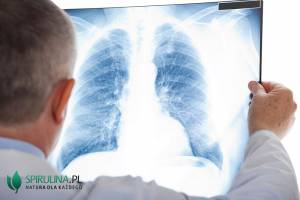 Bezobjawowe zapalenie płuc