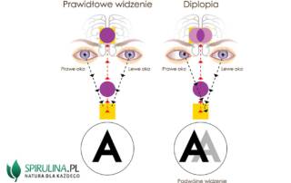 Podwójne widzenie (diplopia)