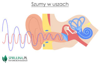 Szumy w uszach