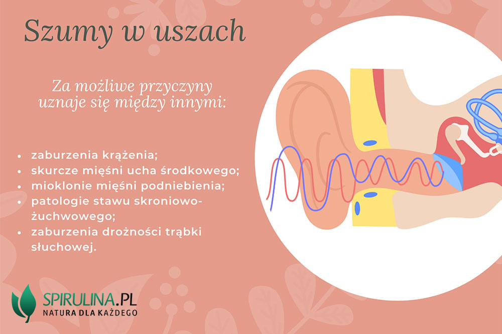 Szumy w uszach