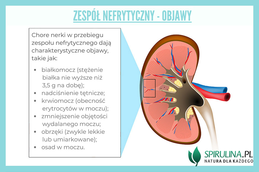 Zespół nefrytyczny objawy