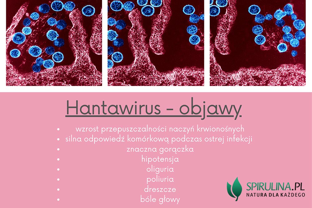 Hantawirus objawy