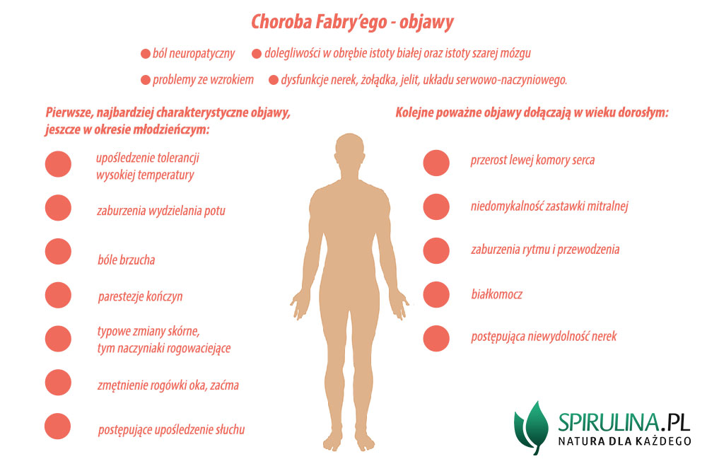 Choroba Fabry’ego