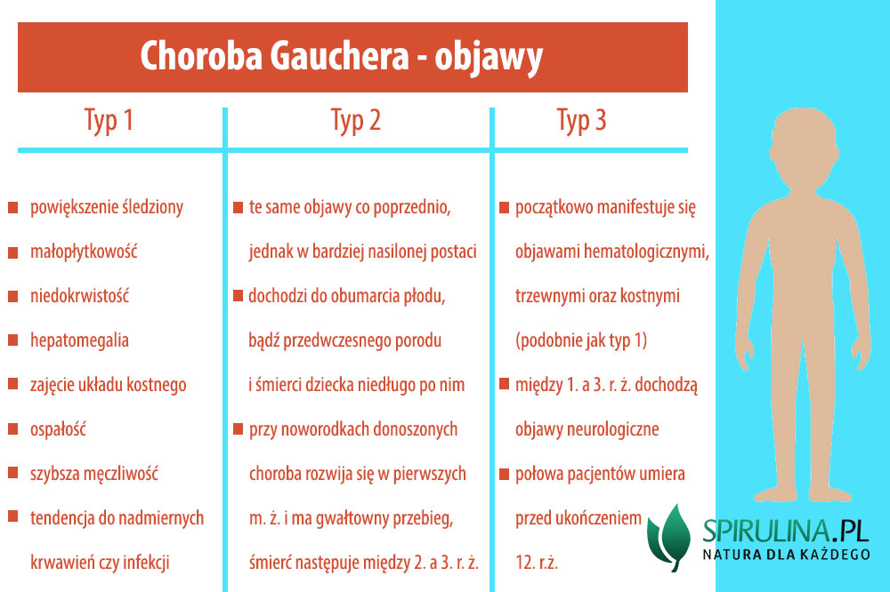 Choroba Gauchera