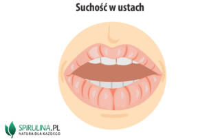 Suchość w ustach