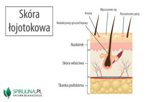 Skóra łojotokowa