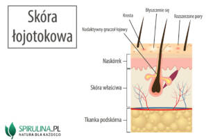 Skóra łojotokowa