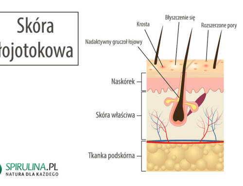 Skóra łojotokowa