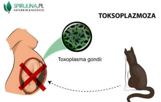 toksoplazmoza