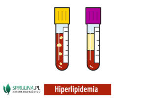 Hiperlipidemia