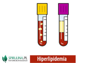 Hiperlipidemia