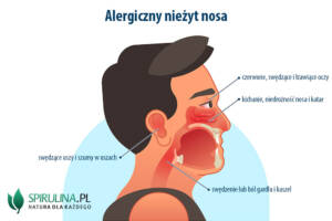 Alergiczny nieżyt nosa