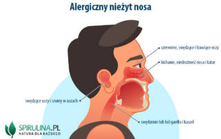 Alergiczny nieżyt nosa