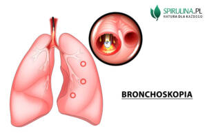 bronchoskopia