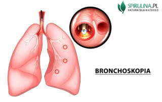 bronchoskopia