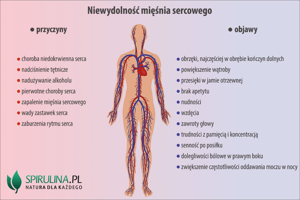 Niewydolność mięśnia sercowego