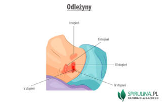 Odleżyny