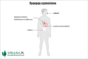 Dyspepsja czynnościowa