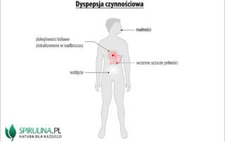 Dyspepsja czynnościowa