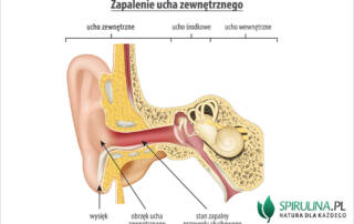 Zapalenie ucha