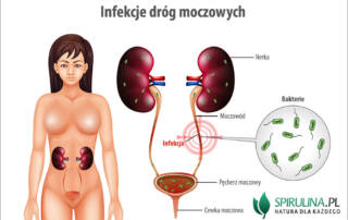 Infekcje dróg moczowych