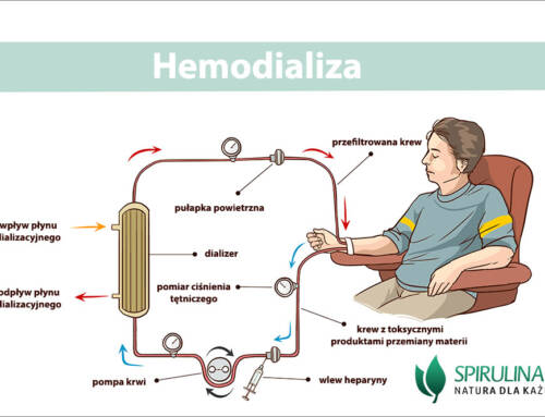 Hemodializa