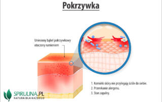 Pokrzywka