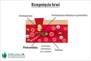 Protrombina