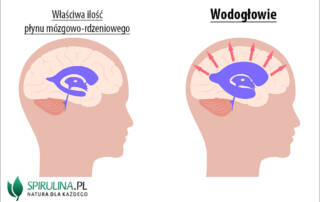 Wodogłowie