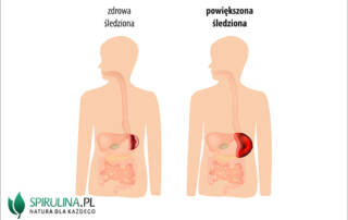 Powiększona śledziona