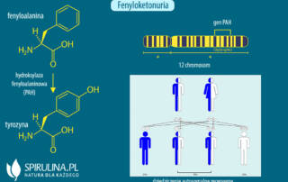 Fenyloketonuria